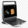 Echographe Portable M30