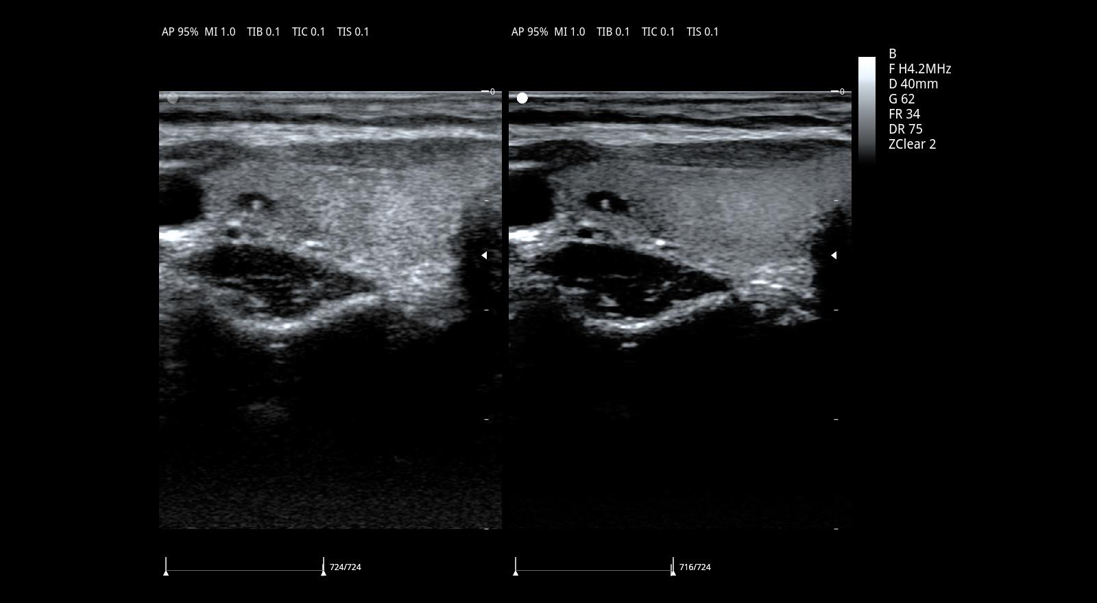 échographe VIV20 ZONCARE – Image 5